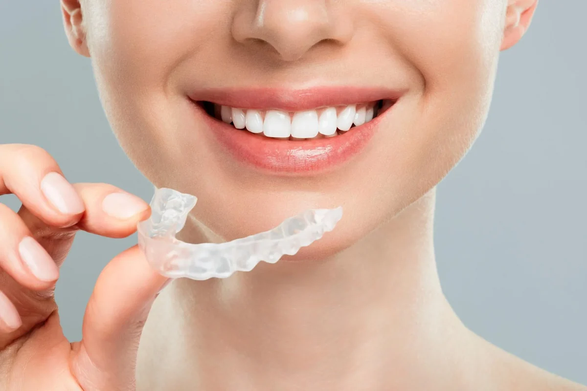 Nakładki Invisalign Warszawa